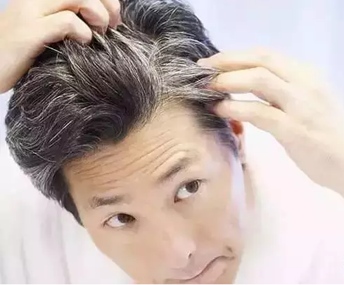白发与身体的关系，后悔知道太晚了。